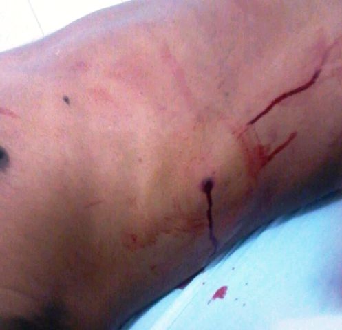 Mais uma vítima da violência crescente em Belmonte.