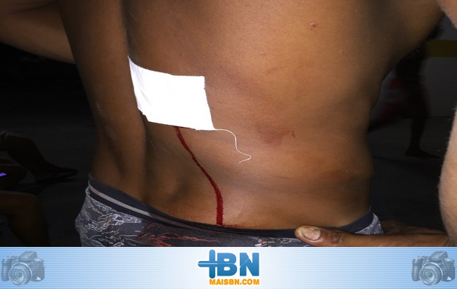 Jovem de 21 anos é atingido por tiro nas costas no Bairro da Biela.