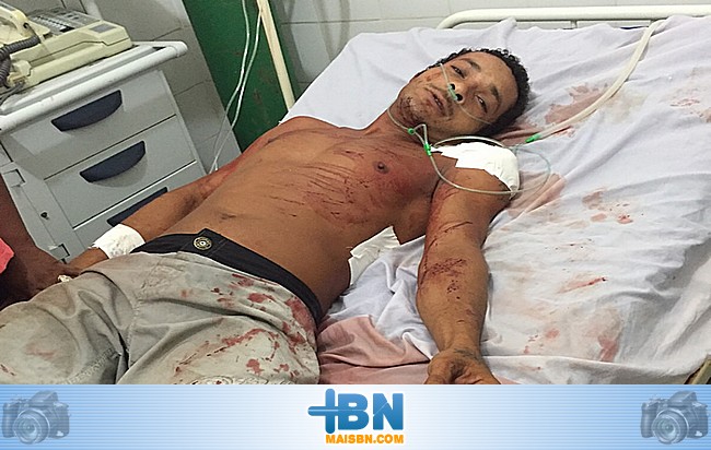 Homem é agredido com golpes de facão no Bairro da Rua Nova em Belmonte.