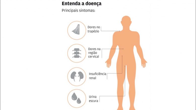 Bahia registra novos casos da doença de Haff e 80% das infecções tem relação com peixe. 6